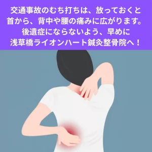 交通事故のムチウチ症状を浅草橋で改善!