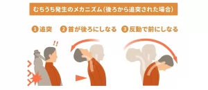 むち打ち、交通事故、浅草橋