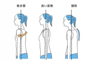 浅草橋で肩こり、首コリ、頭痛を解消する接骨院